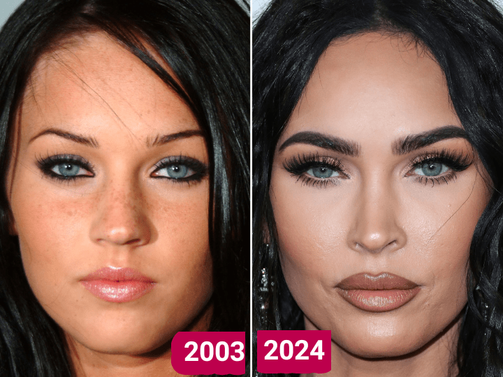 مگان فاکس قبل و بعد عمل